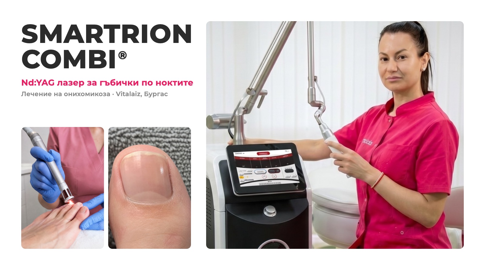 SMARTRION COMBI Nd:YAG лазер за гъбички по ноктите във Vitalaiz, Бургас: апаратът и лечение на нокти