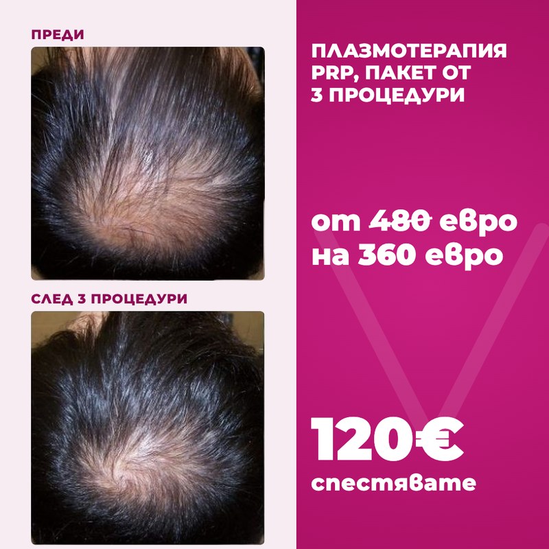 Плазмотерапия PRP, пакет от 3 процедури за 360 евро
